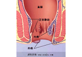 Disease of venous system-Shenzhen Xingyin Pharmaceutical Co., LTD
